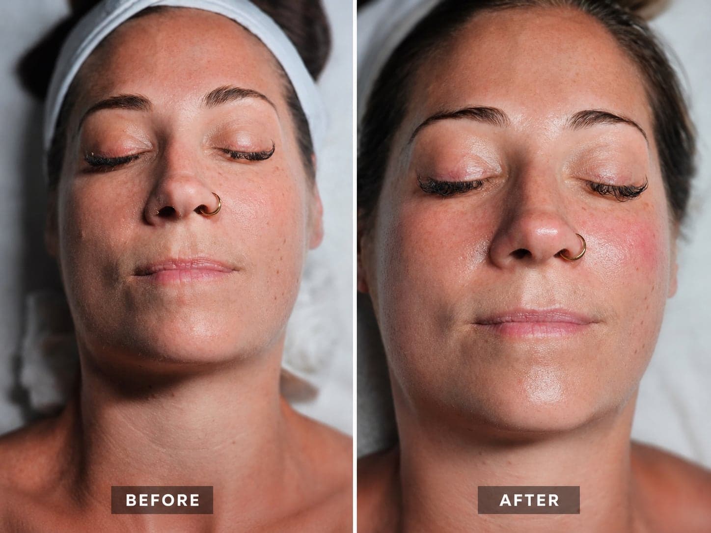 Before and after a facial at Harav Salon & Spa in Winnipeg — skin visibly brighter and more hydrated